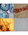Bactéria Citologia e Fungos