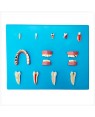 Patologia Dentária com 12 peças  TZJ-0311-P