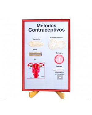 Quadro de Métodos Contraceptivos QMC