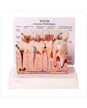 Patologia Dentária e Placa Explicativa TGD-0311-J