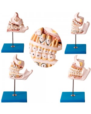 Desenvolvimento da Dentição com 4 Peças  TZJ-0313-D