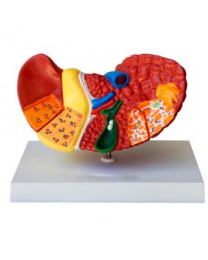 Fígado com Patologia TZJ-0324-P