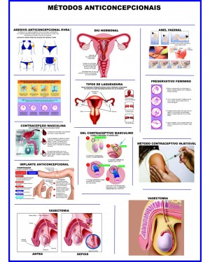 Poster Métodos Contraceptivos 101