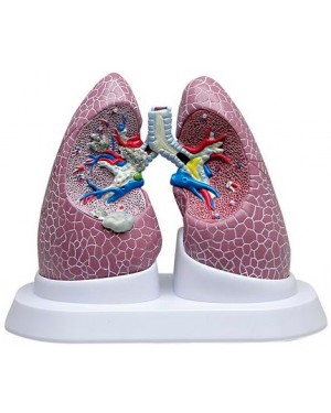pulmão com patologia