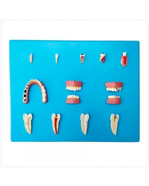 Patologia Dentária com 12 peças  TZJ-0311-P